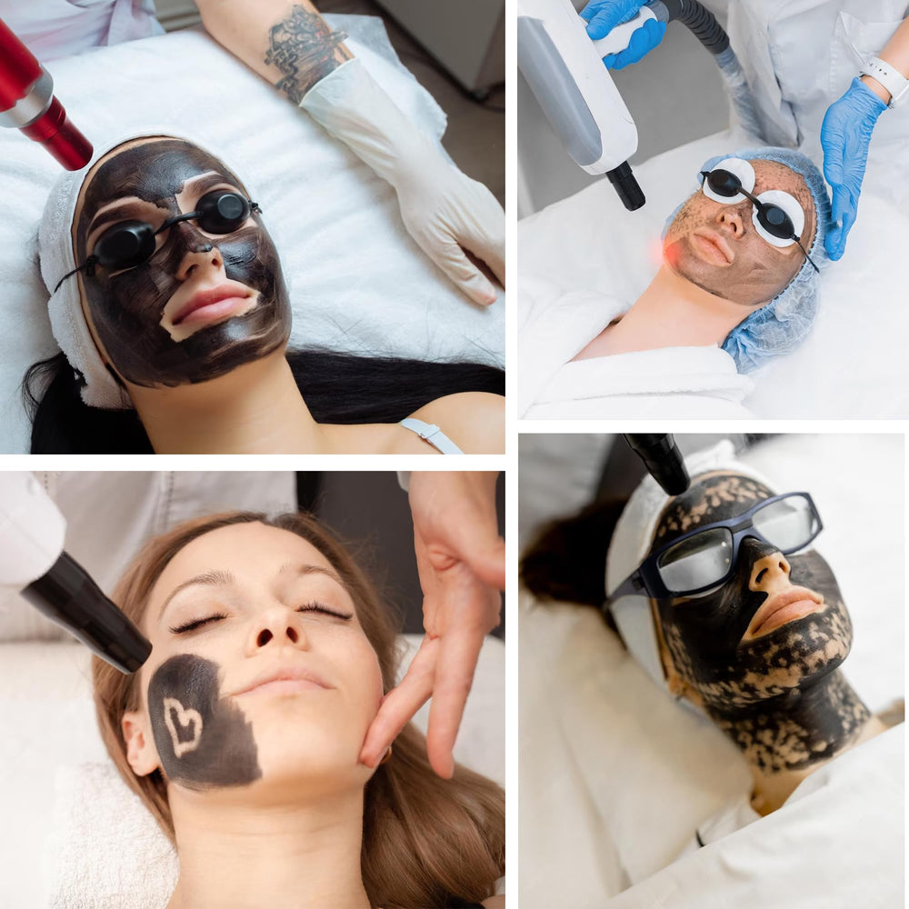 YMEYFAN carbon peeling gel cooling gel aftercare for pampered skin