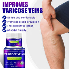 Yongsenina varicose cream application massage demonstrates gentle leg care