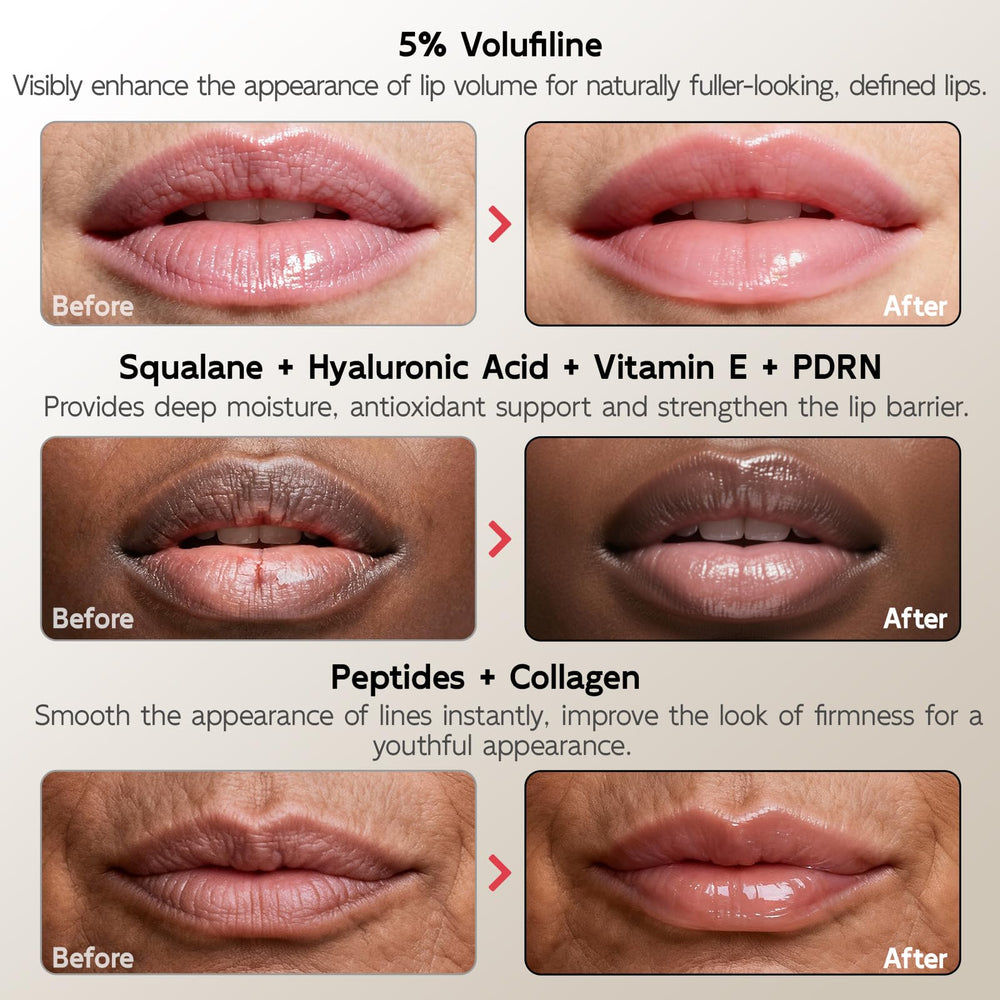 YouthVibe squalane and shea butter lip care delivering deep hydration.