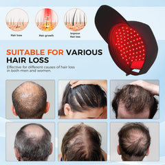 Yuxian Red Light Hair Growth Cap LED panel close-up with 660nm light