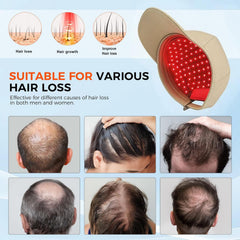 Yuxian Red Light Hair Growth Cap soft fabric feels comfortable during wear.