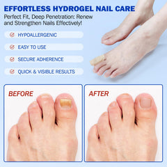 ZBQIEX Nail Repair Patches hydrogel adhesion ensures secure wear through the night for ongoing protection.