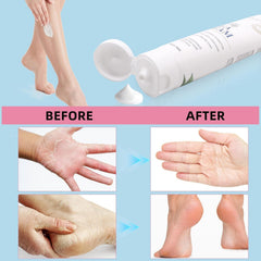 Natural ingredients like glycerin and avocado in Zegrox Urea Cream moisturize.