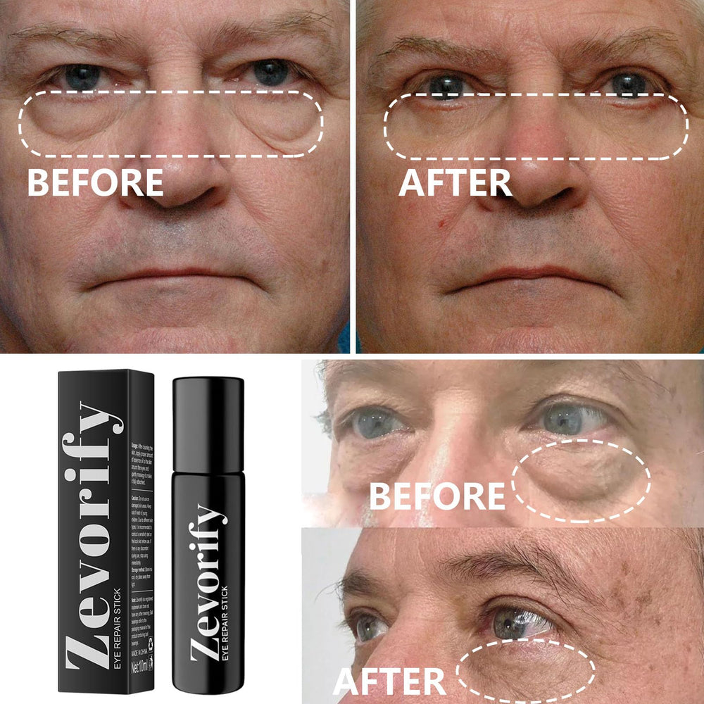 Zevorify Eye Repair Stick uses a lightweight formula suitable for sensitive skin.