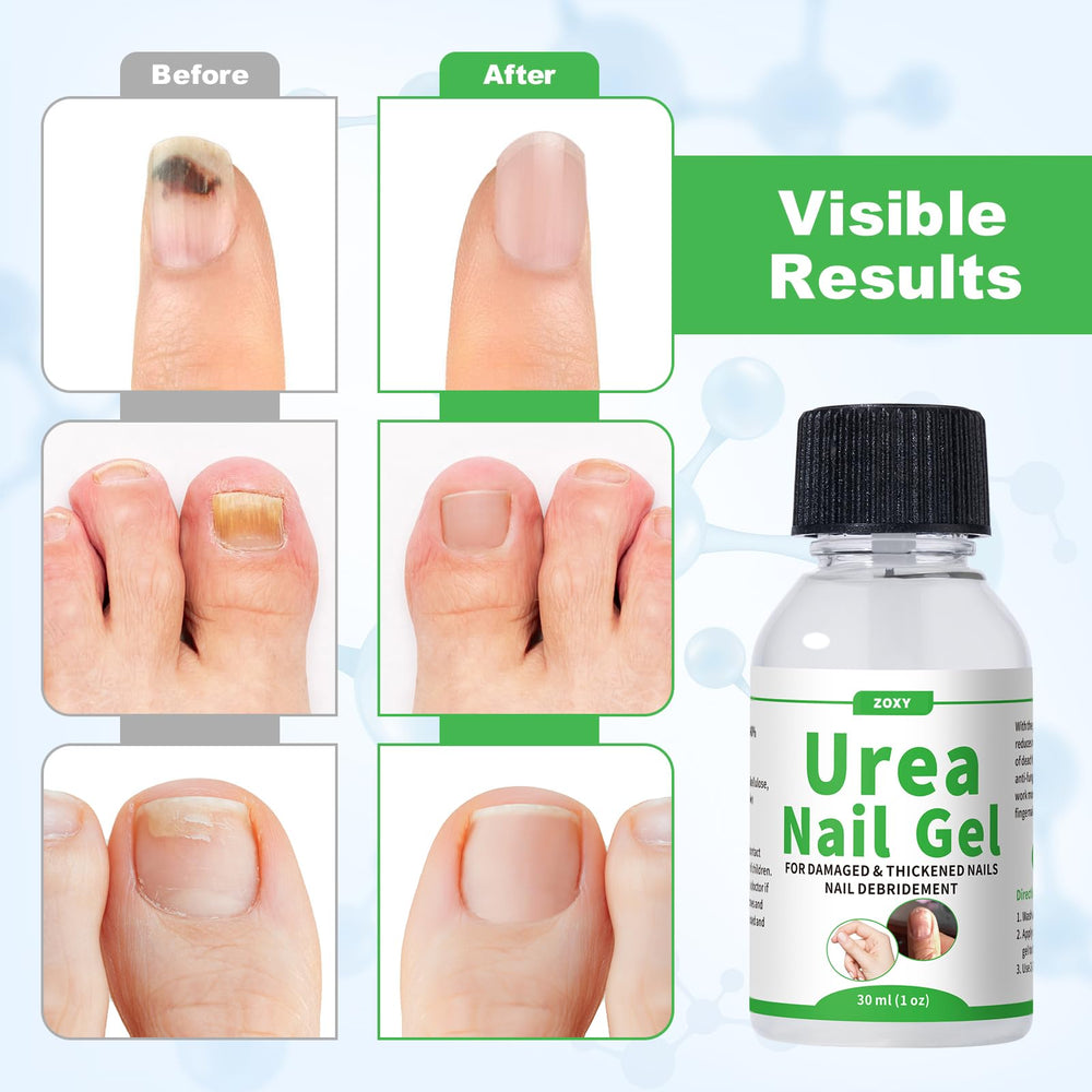 ZOXY Urea Nail Gel strengthens nails over weeks for long-term resilience.