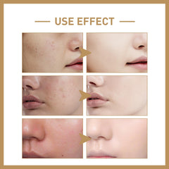 ZTSGU Relief rice extract highlights nourishing, balanced daily protection.
