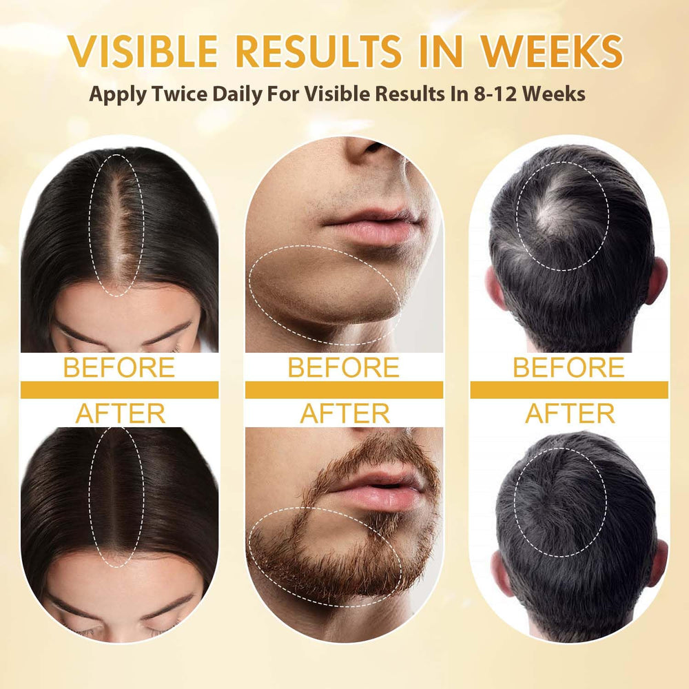 ZYXN Minoxidil packaging box shown for at-home hair care.