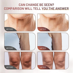ZZILME Crepe Fix Cream hands with smoother, hydrated appearance.