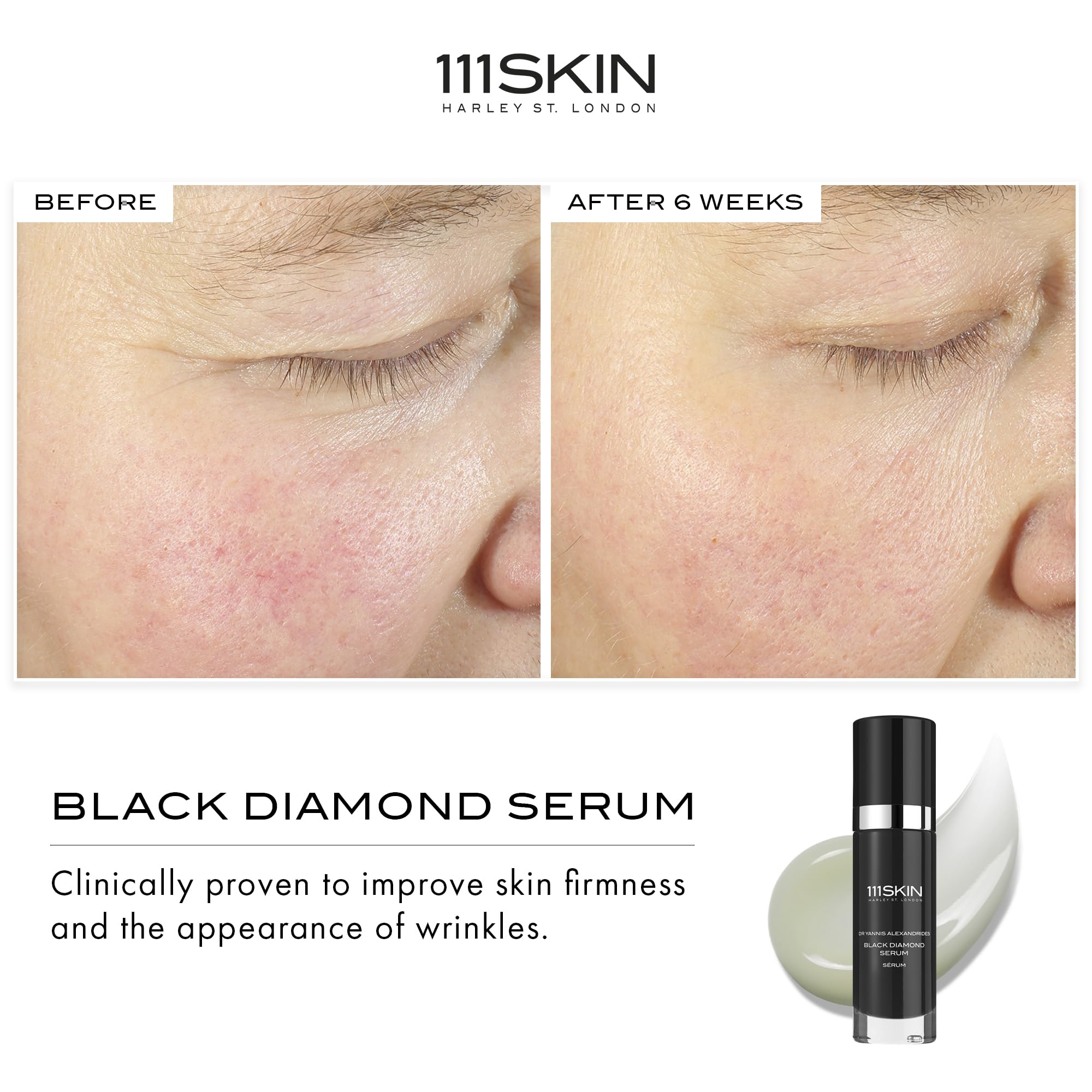 111SKIN application routine scene demonstrating lightweight gel for daily hydration.