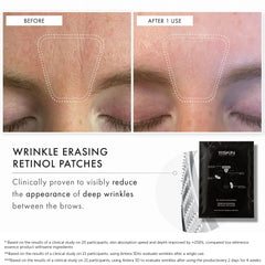 111SKIN overnight patches designed for targeted facial areas.