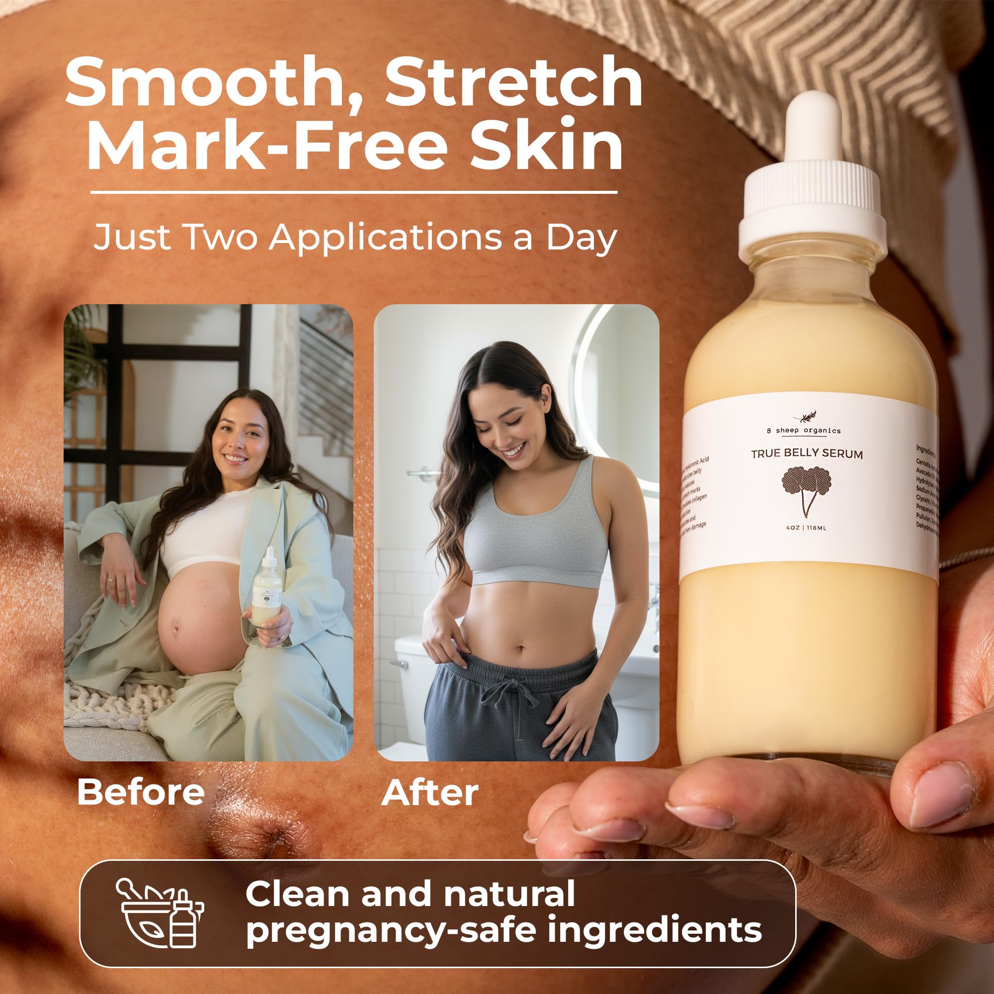 Centella Asiatica ingredient spotlight on 8 Sheep Organics True Belly Serum