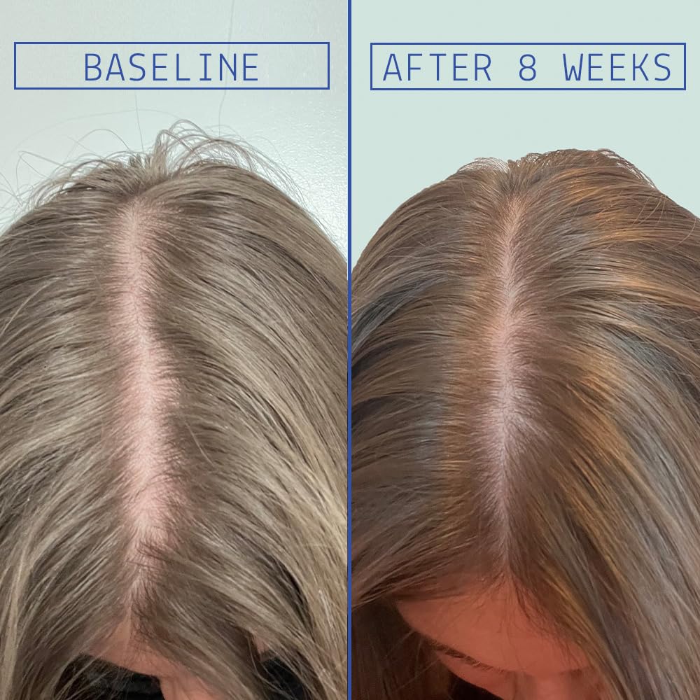 AAVRANI Hair Density Serum dropper ready to apply on scalp