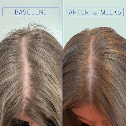 AAVRANI Hair Density Serum dropper ready to apply on scalp