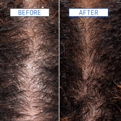 AAVRANI Scalp Detox Jelly Cleanser glycolic acid action on scalp for gentle cleansing.
