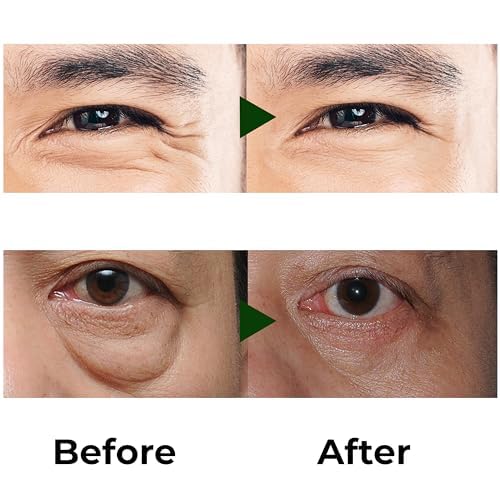 Abera Eye Roller Serum built-in cooling roller for even application