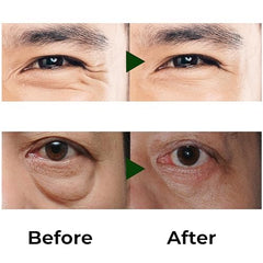 Abera Eye Roller Serum built-in cooling roller for even application