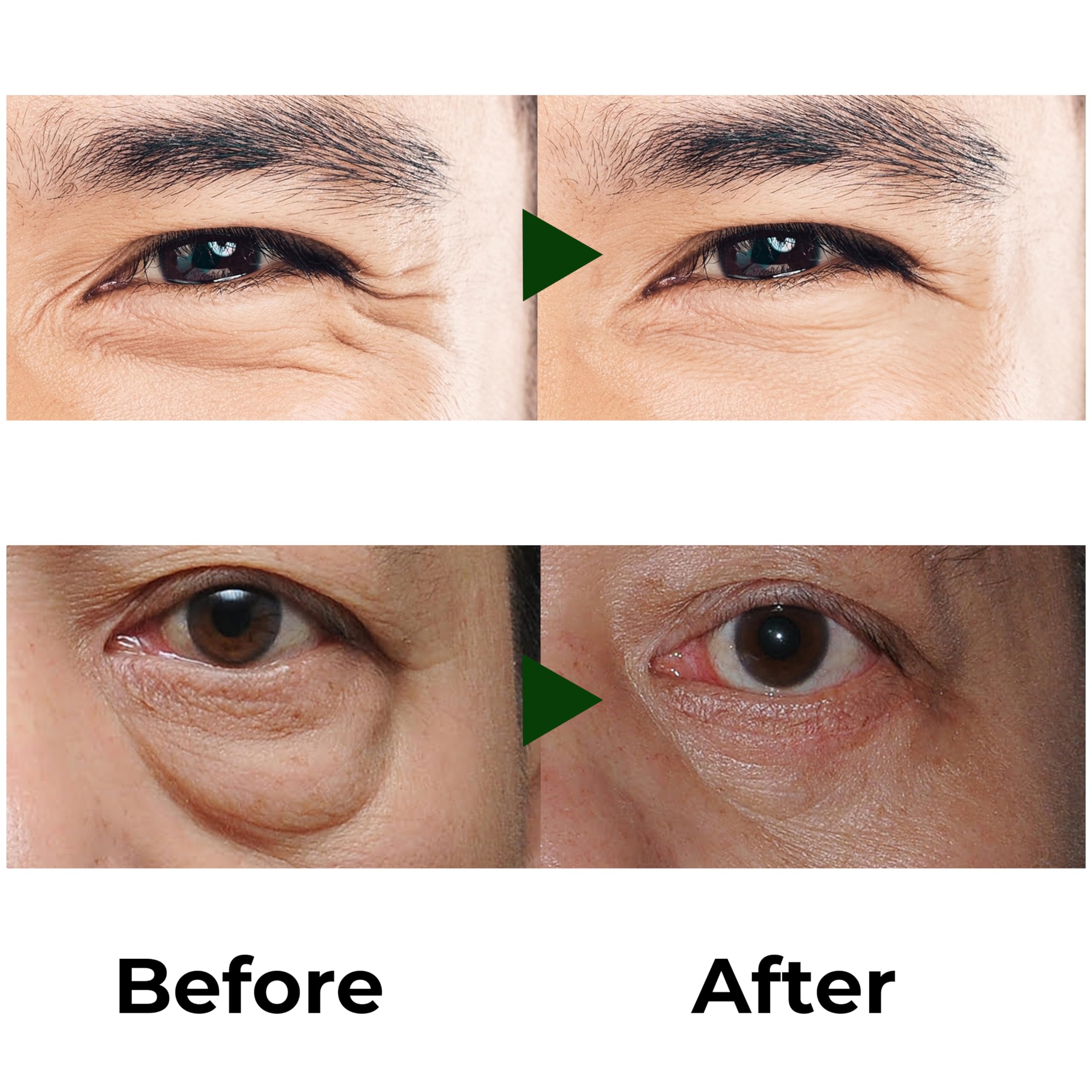 ABERA hydrates delicate under-eye skin with vitamin C and peptides.