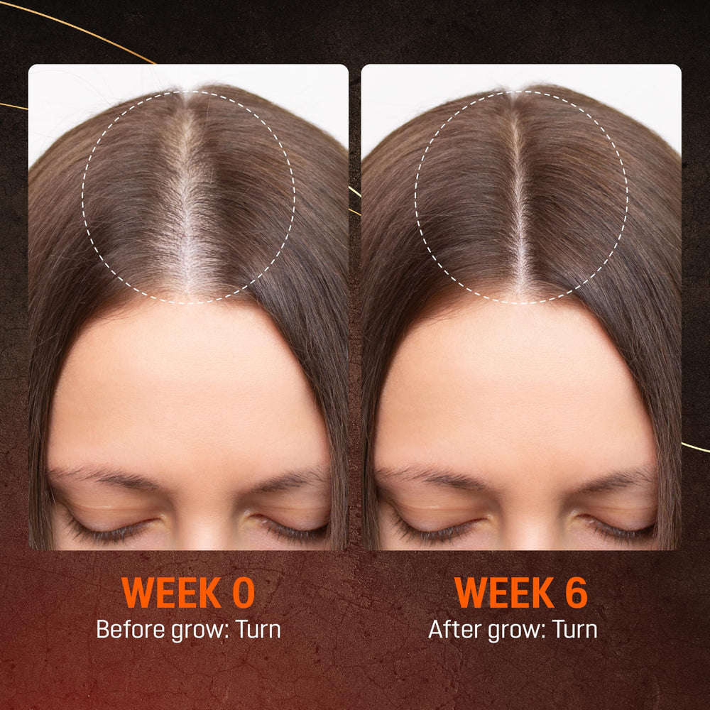 ABERA hair growth serum in hand for easy daily use.