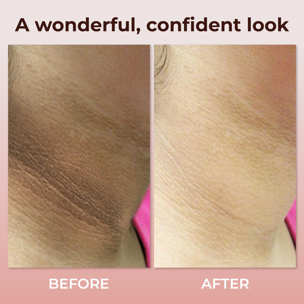 ABERA neck cream SPF guard visual implying sun defense for delicate neckline.