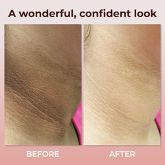 ABERA neck cream SPF guard visual implying sun defense for delicate neckline.