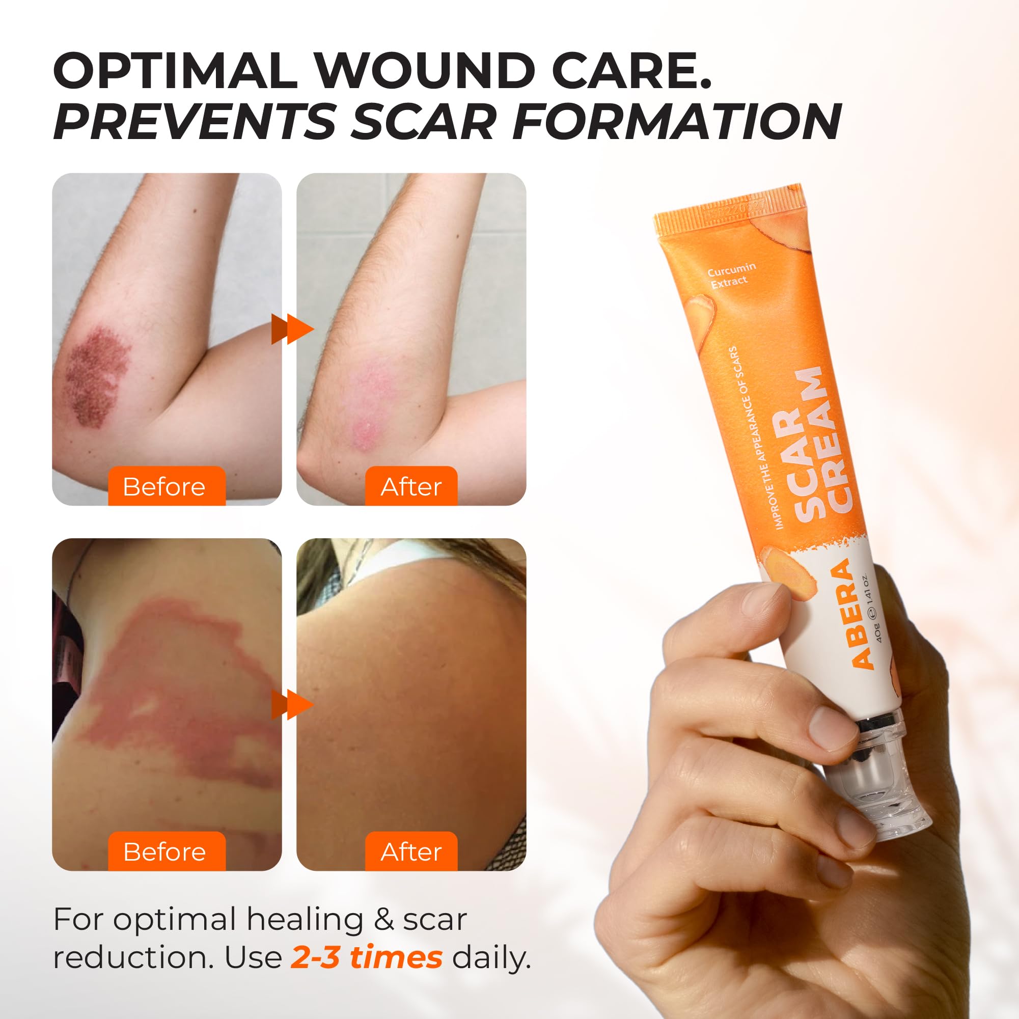 ABERA Scar Cream Upgrade application scene illustrating soothing relief for irritated skin.