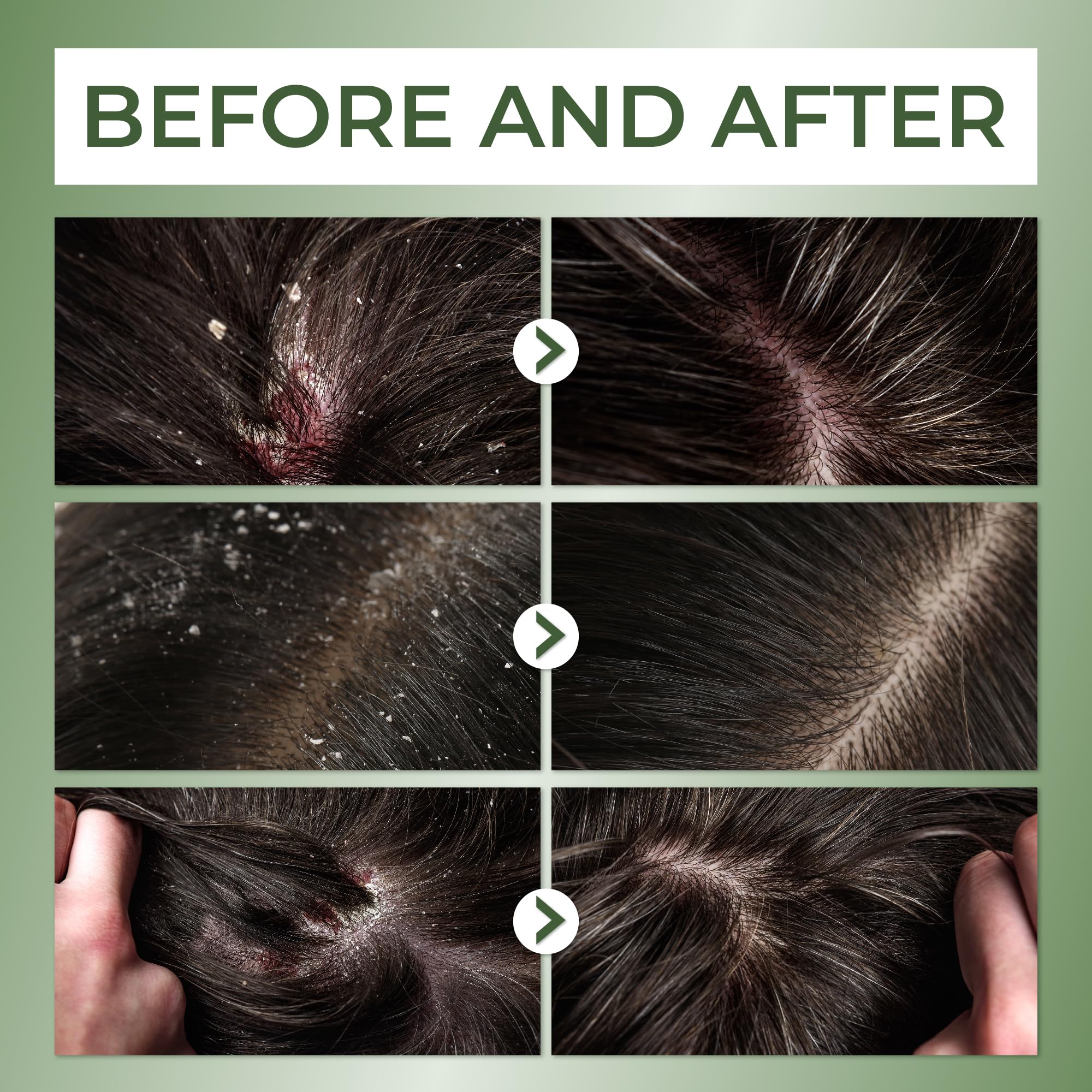 ABERA sulfate-free paraben-free formula emphasizes safe care for sensitive scalps.