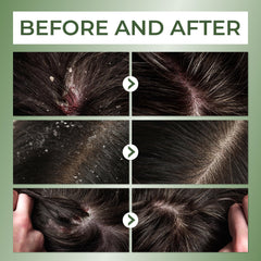 ABERA sulfate-free paraben-free formula emphasizes safe care for sensitive scalps.