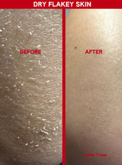 ABI AME skin after use shows visibly smoother texture