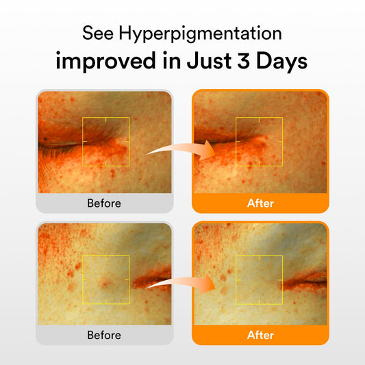 Abib Glutathiosome serum texture on skin highlighting quick absorption and non-greasy finish