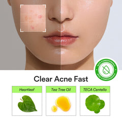 Beveled-edge Abib patch for seamless makeup wear.