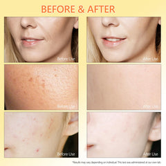 ABOTE hyaluronic acid 1 percent shot indicating deep hydration