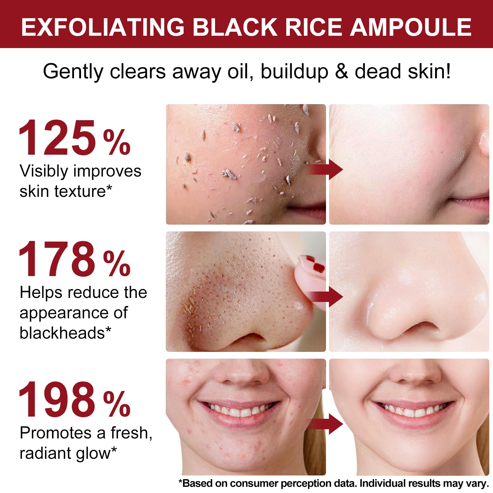 ABOUME Peel Shot Duo face and body use demonstrates versatile exfoliation.