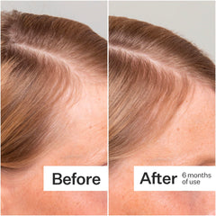 ACT+ACRE display of ingredients bamboo and pea extract for scalp elasticity.