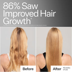 ACT+ACRE Stem Cell Shampoo scalp hydration close-up emphasizing moisture delivery.