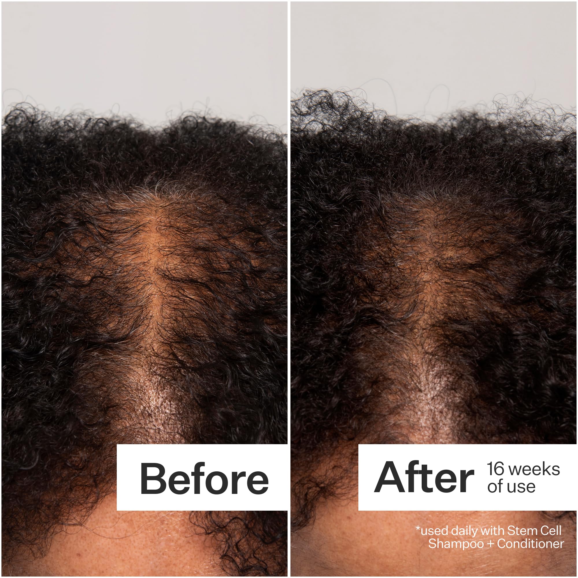 Act+Acre clinical results graphic summarizes 12-week shedding reductions