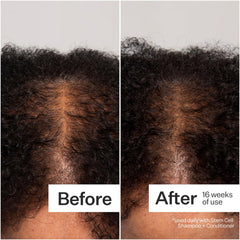Act+Acre clinical results graphic summarizes 12-week shedding reductions