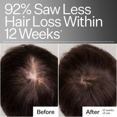 Act+Acre graphic of growth peptides emphasizing scalp elasticity