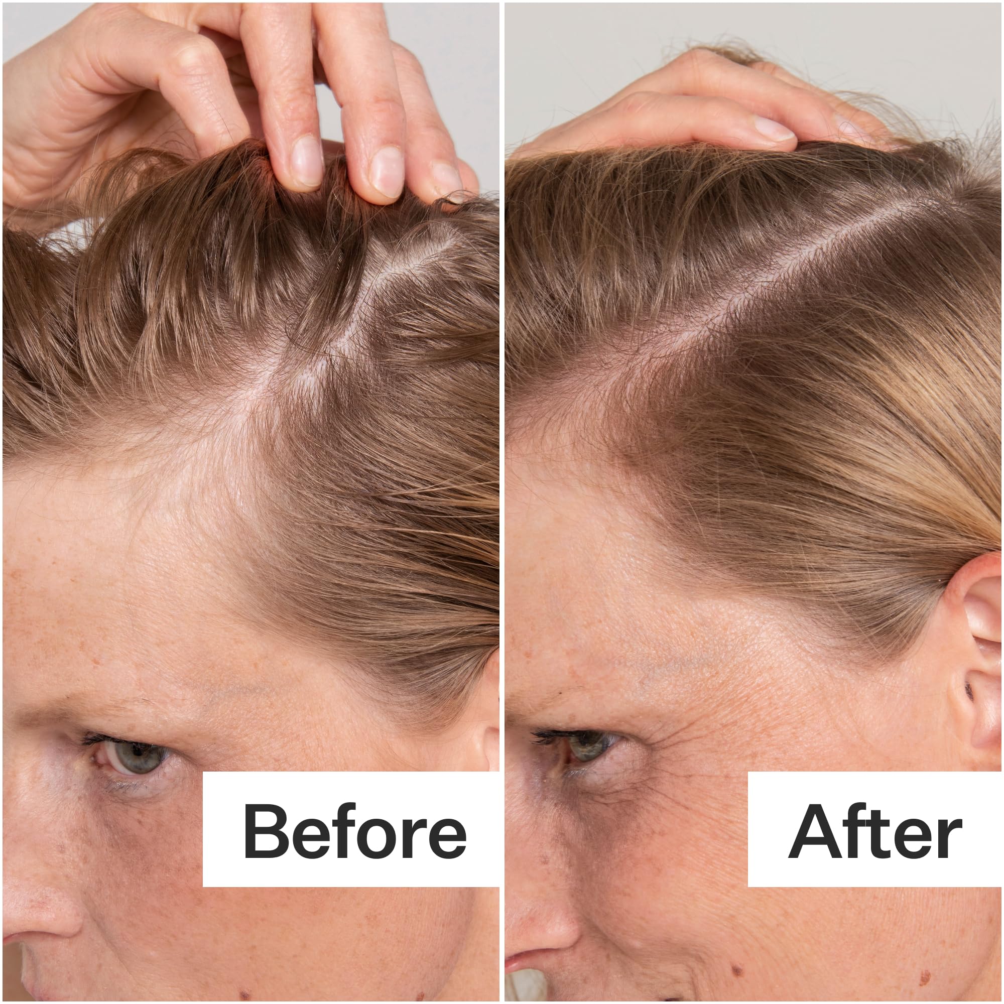 Peppermint oil cooling effect visible on ACT+ ACRE exfoliator surface