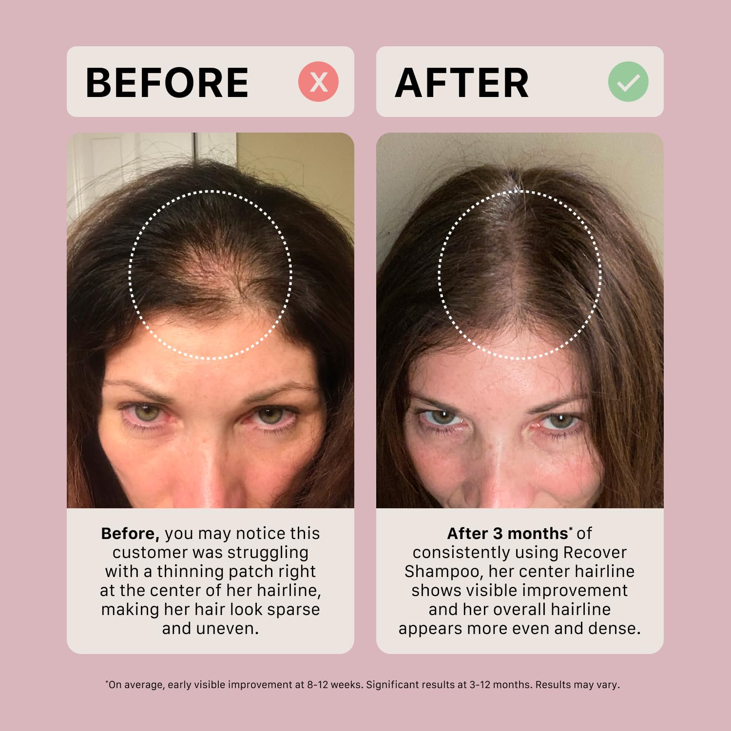 ACTIIV Recover scalp-area application demonstrates scalp health support potential