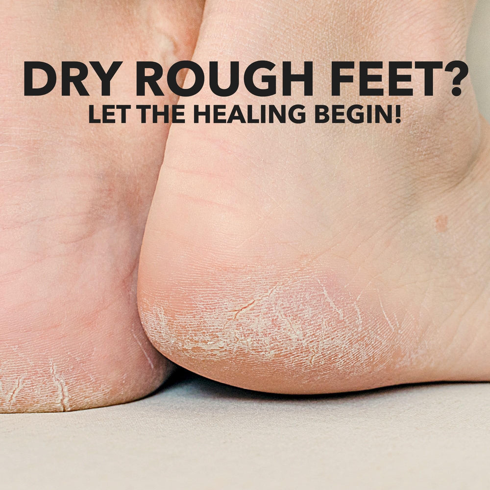 Packaging of Adamia Therapeutic Repair Foot Cream displayed for reference.