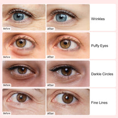 Adofect under eye patches blue pack for firmer, smoother eye area