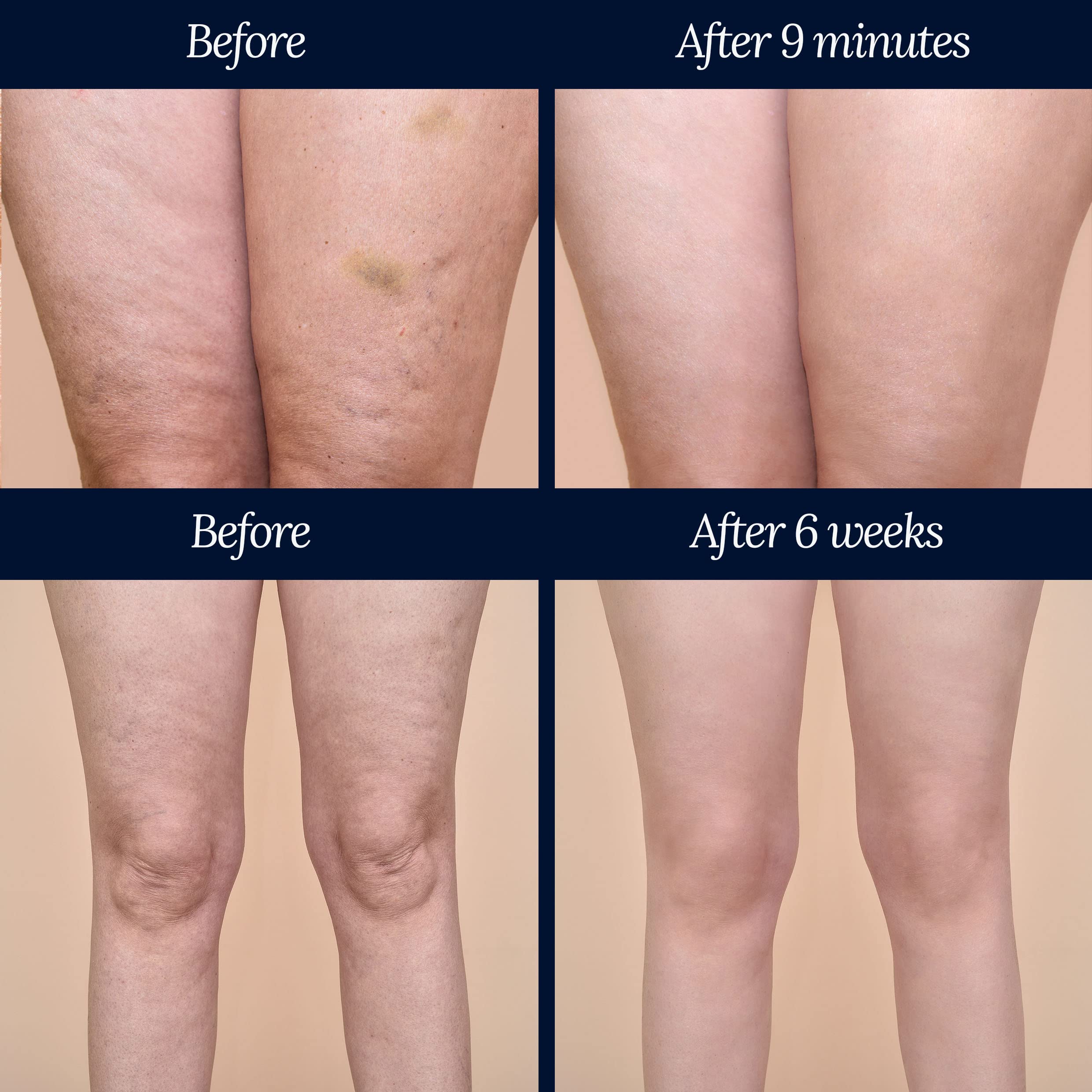 Adonia Organics LegTone lab results image hints at noticeable improvement in skin appearance