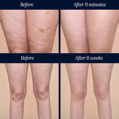 Adonia Organics LegTone lab results image hints at noticeable improvement in skin appearance