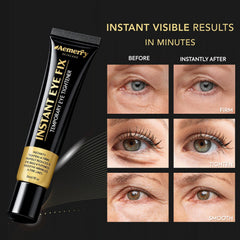 Under-eye puffiness close-up with diminished tired appearance using Aemerry