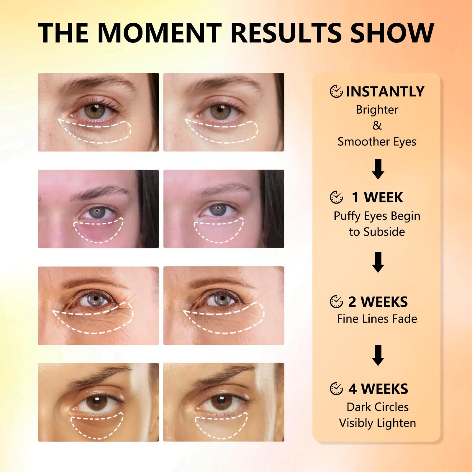 Niacinamide presence suggests smoother-looking skin around the eye.