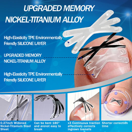 Aethyron titanium alloy material highlights durable toenail correction