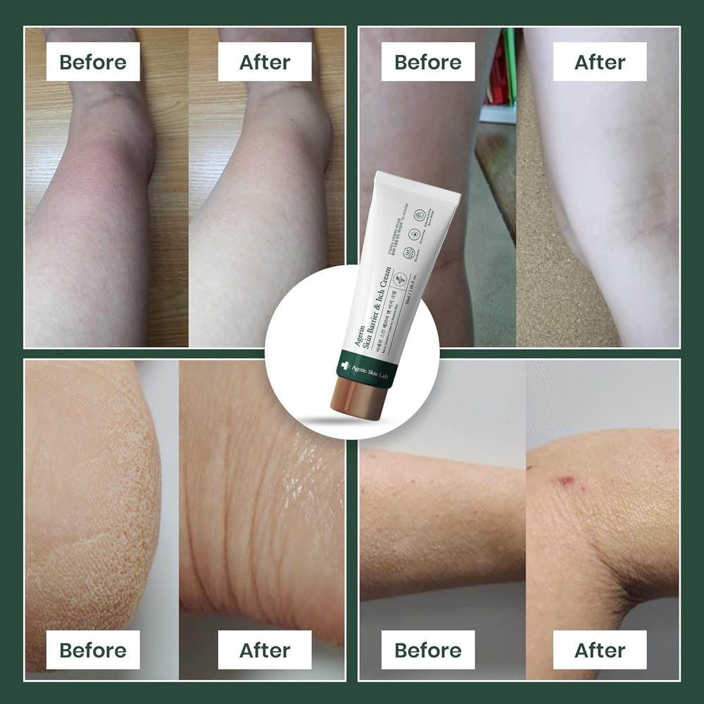 Barrier protection concept showing hydrated skin after use.