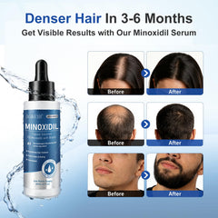 AGIKENB minoxidil for beard area application