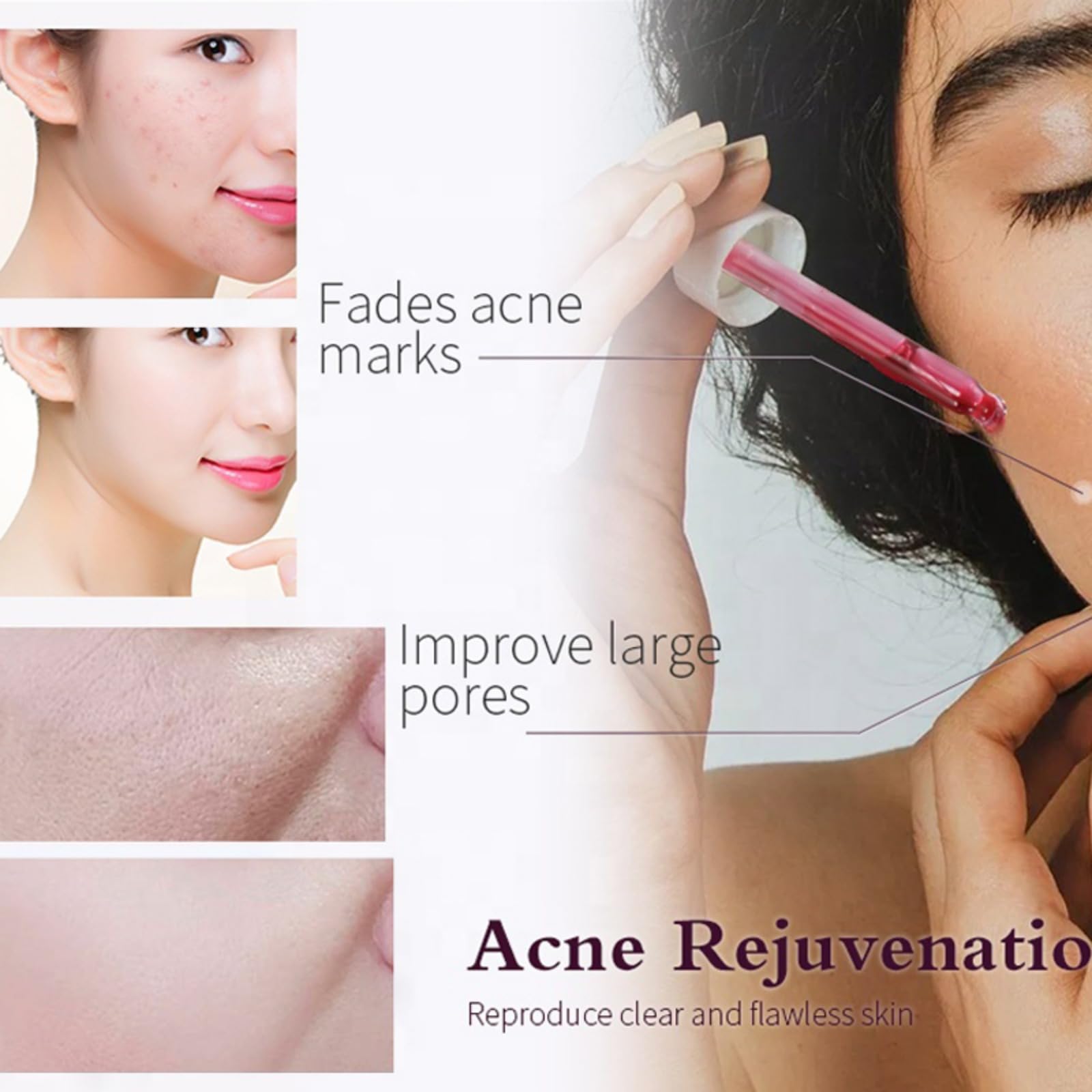 AHA 30% + BHA 2% peeling solution label emphasizes hyaluronic acid hydration