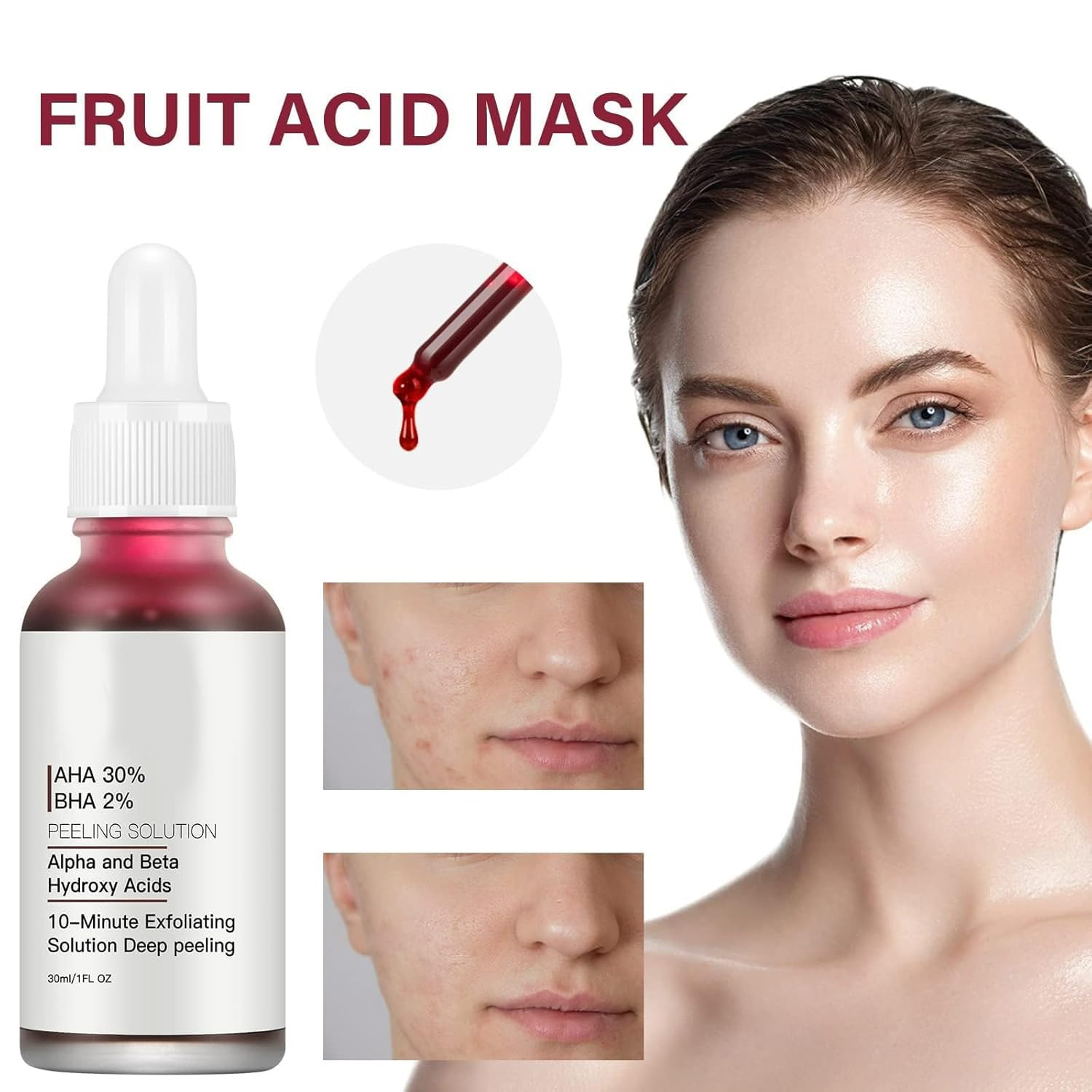AHA 30% + BHA 2% peeling solution packaging with calming botanicals in view